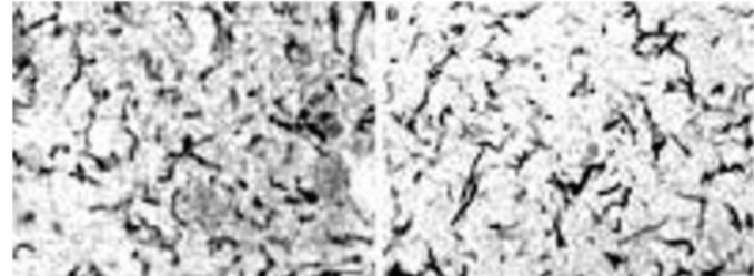 Figure 3. Syphilis and AD pathology comparison of the spirochetes in each disease.
