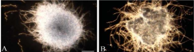 Figure 5A. Cultured BB from AD brains, immediately post-mortem, forms biofilms.