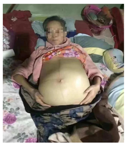 Picture 1.3. Before stem cell treatment (left)