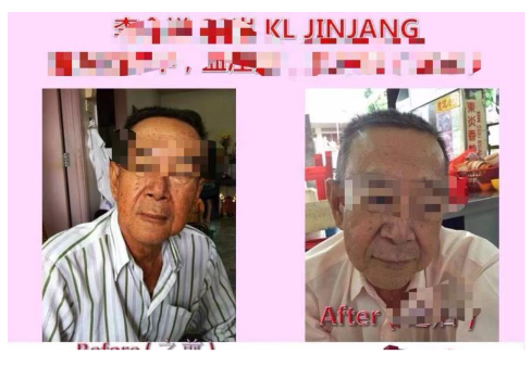 Picture 5. Before consuming stem cells (left)