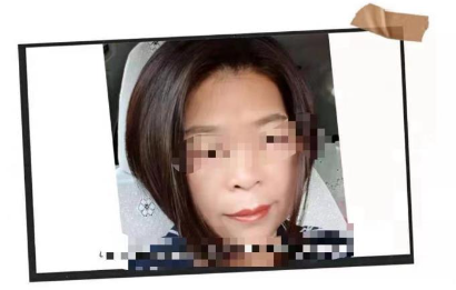 Picture 9. The photo above is a beauty photo after stem cell anti-aging treatment.