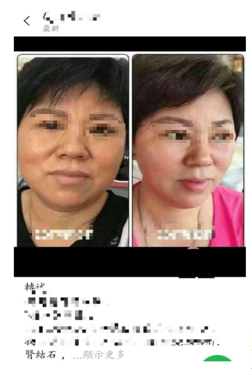 Picture 8. After consuming stem cells for one month (right)