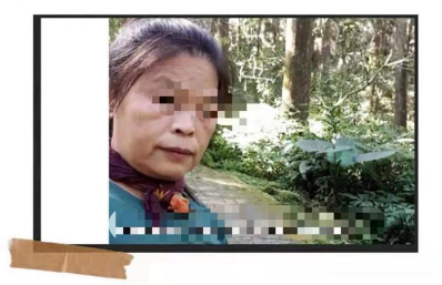 Picture 10. The photo below is a photo without stem cell treatment.