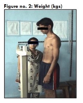 Figure no. 2: Weight (kgs)