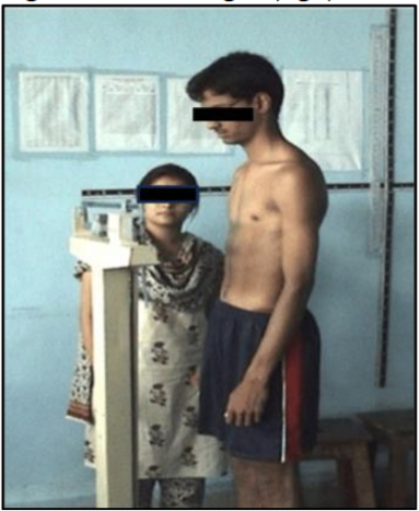 Figure no. 2: Weight (kgs)