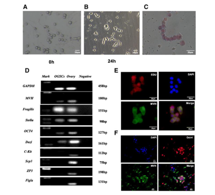 Figure 1. Courtesy ref no-38 - Identification of female germline stem cells. (A-F reproduced with the permission from Fig. 5 A-; Reproductive Biology and Endocrinology; https://doi.org/10.1186/s12958-021-00699-z). A, B. The morphology of FGSCs; C Alkaline phosphatase staining; D Reverse transcription polymerase chain reaction (RT-PCR); E, F Immunofluorescence
