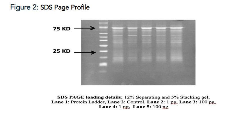 Figure 2: SDS Page Profile