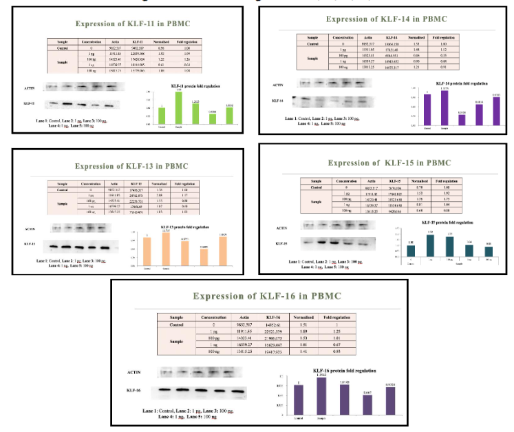 Figure 5: Western blot images of KLF 11, 13, 14, 15, 16