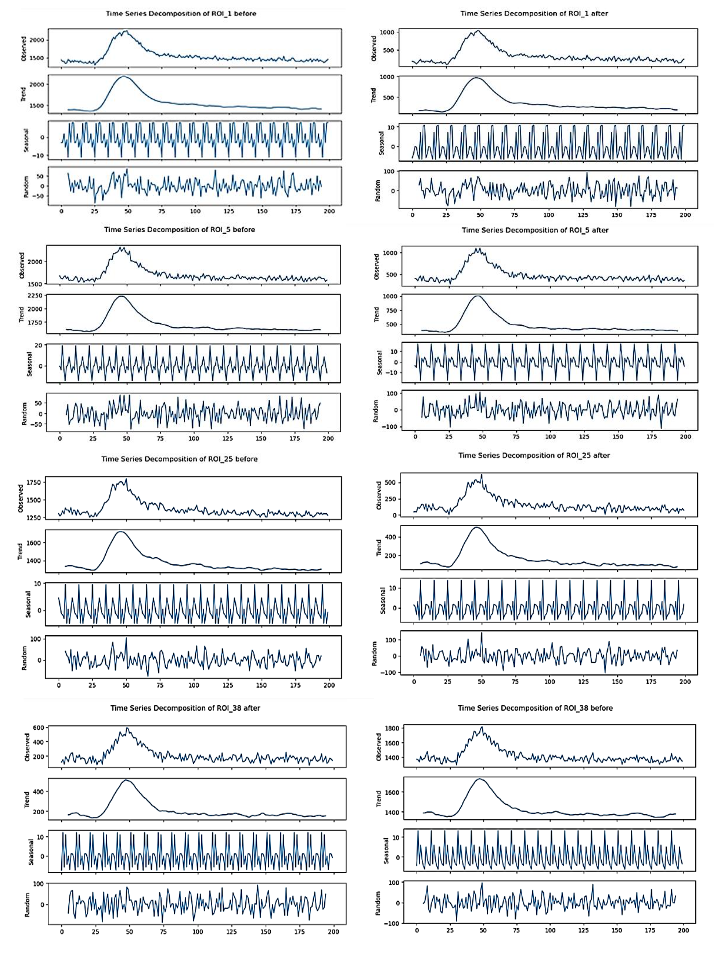 Figure 1: Decomposition Graph of Regions of Interests Before and After Stimulation