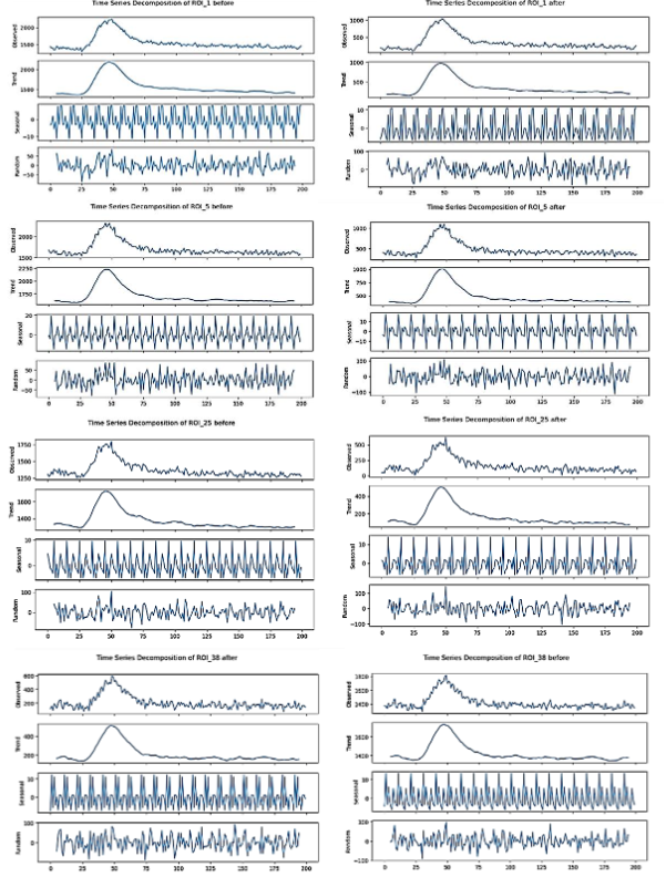 Figure 1: Decomposition Graph of Regions of Interests Before and After Stimulation