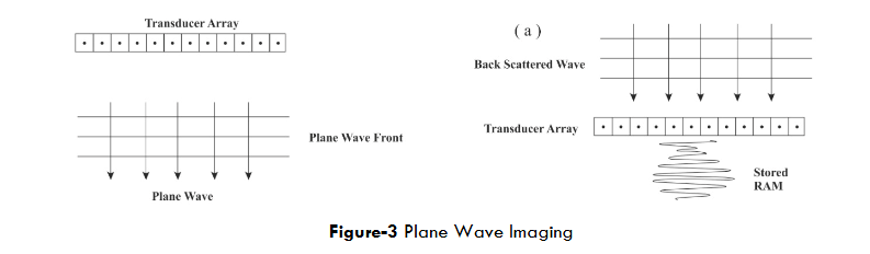 Figure-3 Plane Wave Imaging