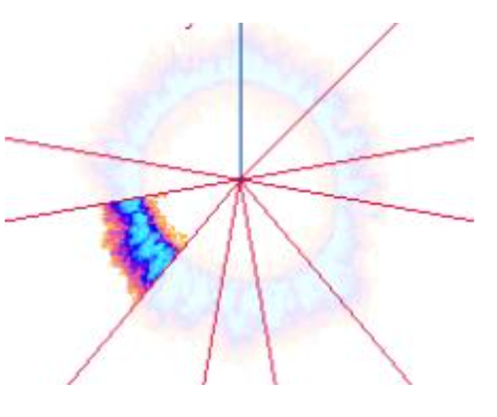 Picture 3. Left Fore Finger Analyzed for a sector of corona associated with Sigmoid Colon sector.