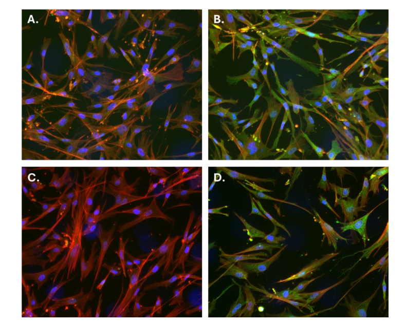 Figure 1: Immunofluorescent detection of p53 protein in chicken corneal epithelial cells. Representative images of CCEC stained with two different α-human p53 antibodies A.- B. PAb 421 or C.-D. Biotium 2092R. Green fluorescence corresponds to p53 staining, red indicates actin filaments (647-phalloidin), and blue points to nuclear DNA (DAPI). Slides were further stained with either a Cy3-AffiniPure Gα-R IgG (111-165-047, Jackson), or Cy™3 AffiniPure® Gα-M IgG (111-165-166). A. and C. represent controls (no primary antibodies), while B. and D. show positive staining for p53 in the cytoplasmic compartment.