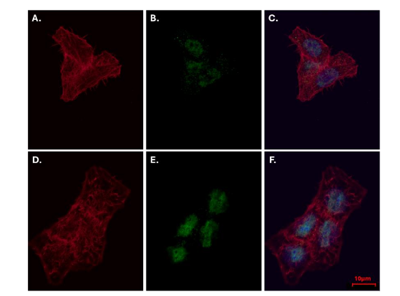 Figure 4: Nuclear translocation of extracellular vesicles-delivered chicken p53 in human p53-knockout cancer cells. Representative immunofluorescence images of HCT116 p53 KO cells stained for actin (647-Phalloidin, red), nuclear DNA (DAPI, blue) and p53 (green; Biotium α-human p53 Ab followed by Cy3-conjugated 2nd Ab). A.–C. Prior to EV addition: a low p53 signal is detected, consistent with background or minimal cross-reactivity in p53-null cells. D.–F. Twenty minutes upon application: a marked increase in green fluorescence is observed, with clear cytoplasmic and nuclear localization, indicating efficient uptake and nuclear translocation of EV-delivered p53. Scale bar=10 µm.