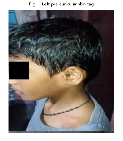 This image has an empty alt attribute; its file name is image-101.png