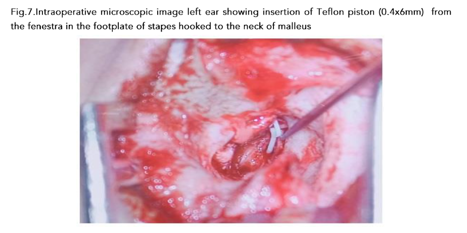 This image has an empty alt attribute; its file name is image-103.png