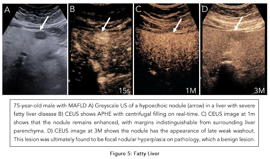 This image has an empty alt attribute; its file name is image-105.png