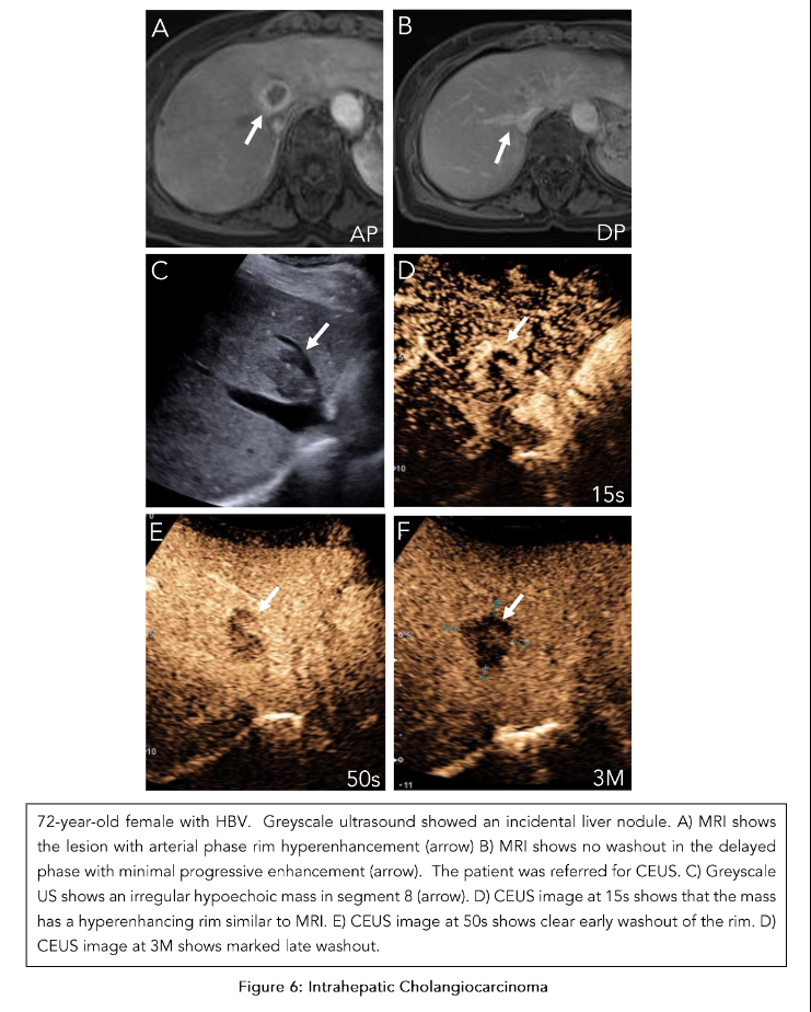 This image has an empty alt attribute; its file name is image-106.png