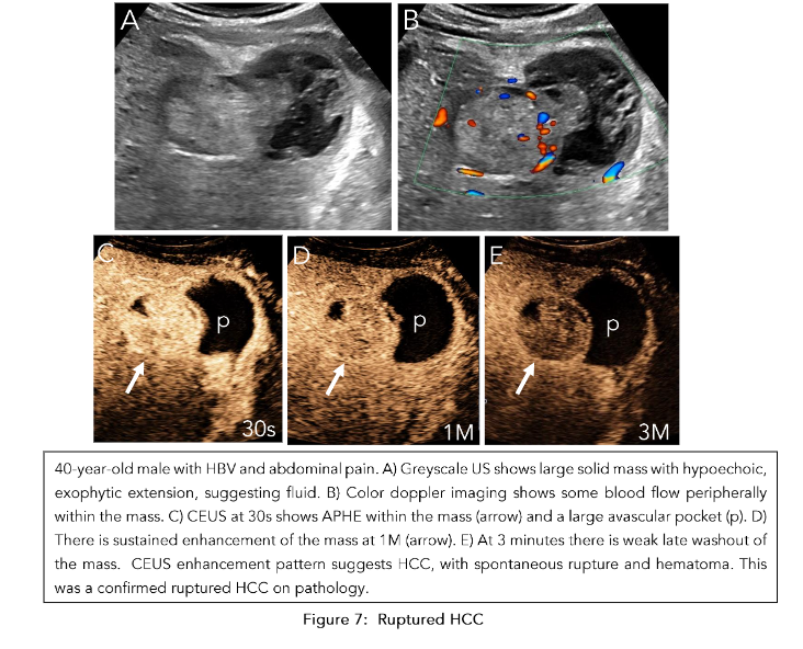 This image has an empty alt attribute; its file name is image-107.png