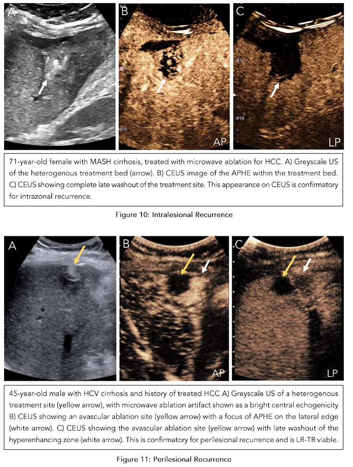 This image has an empty alt attribute; its file name is image-109.png