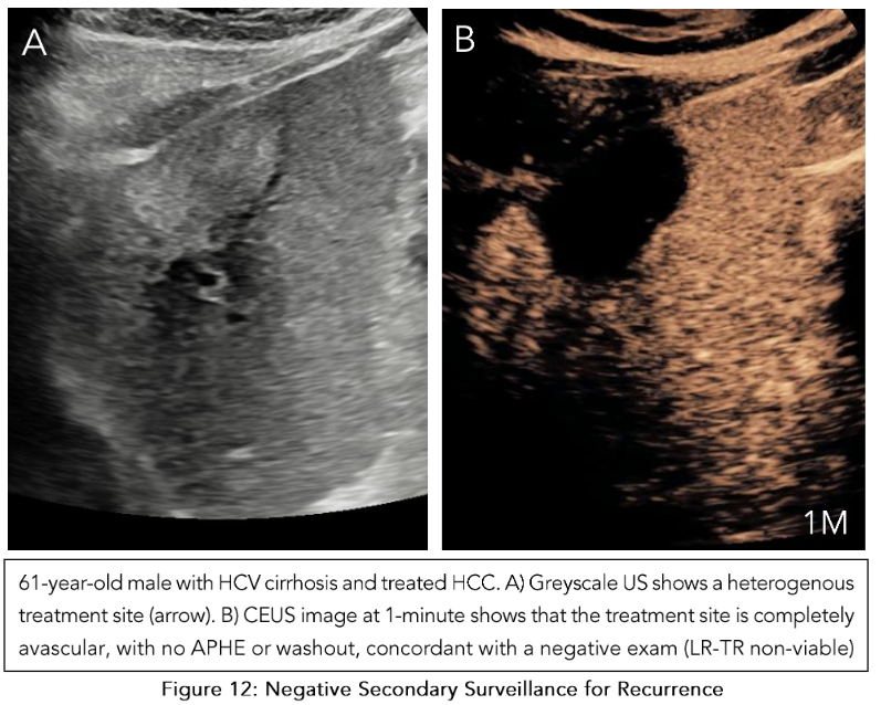 This image has an empty alt attribute; its file name is image-110.png