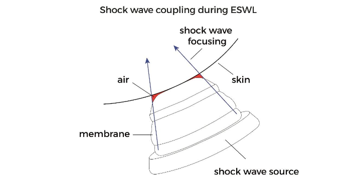 This image has an empty alt attribute; its file name is image-173.png