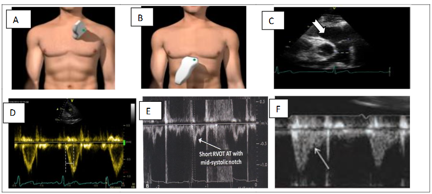 This image has an empty alt attribute; its file name is image-217.png