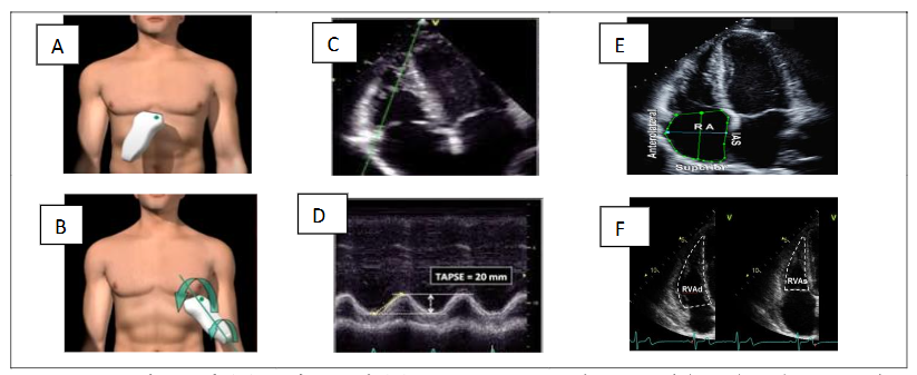 This image has an empty alt attribute; its file name is image-218.png