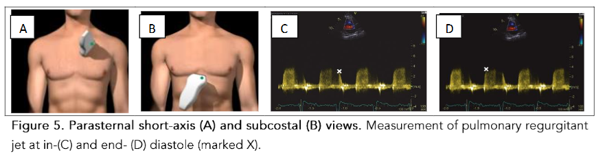 This image has an empty alt attribute; its file name is image-219.png