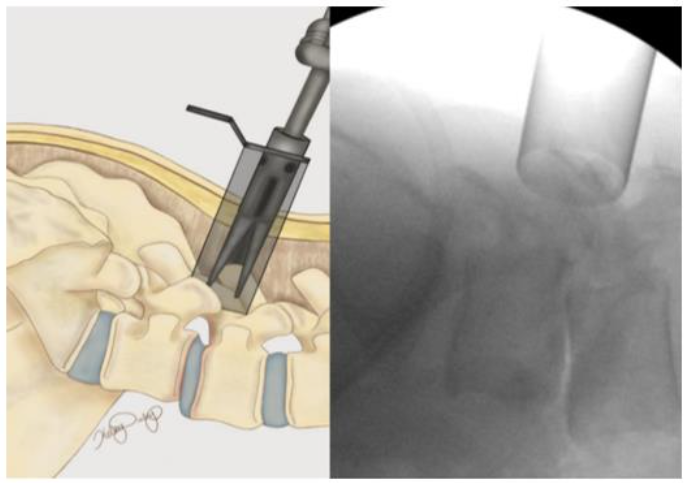 This image has an empty alt attribute; its file name is image-236.png