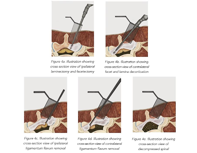 This image has an empty alt attribute; its file name is image-237.png