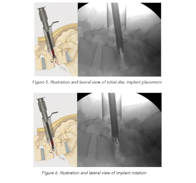 This image has an empty alt attribute; its file name is image-238.png