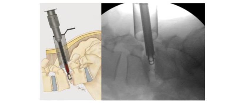 This image has an empty alt attribute; its file name is image-239.png