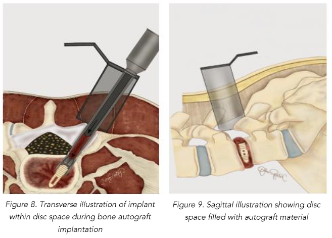 This image has an empty alt attribute; its file name is image-240.png