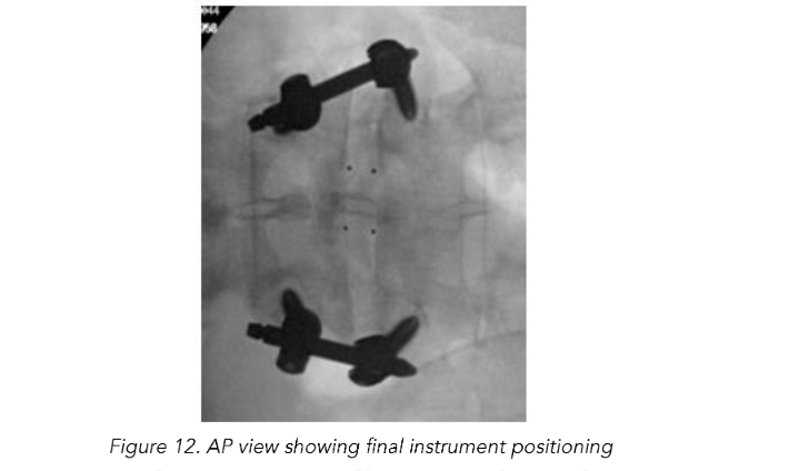 This image has an empty alt attribute; its file name is image-242.png