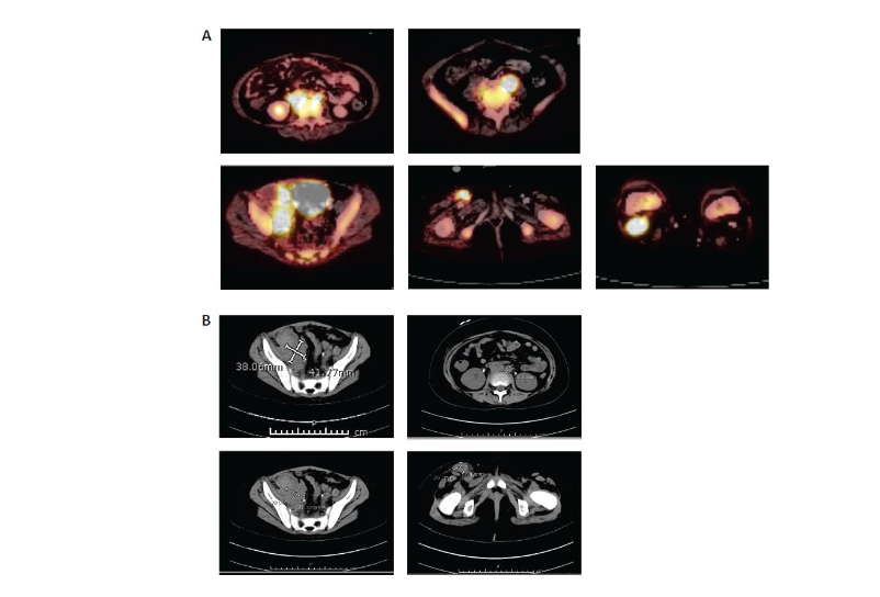 This image has an empty alt attribute; its file name is image-274.png