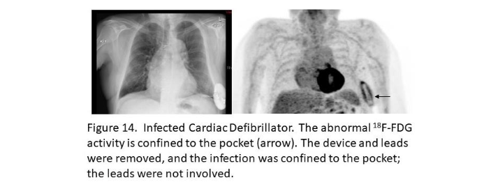 This image has an empty alt attribute; its file name is image-287.png