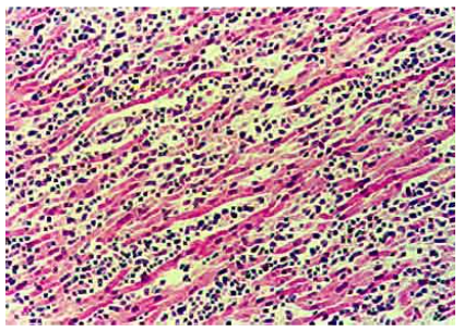 This image has an empty alt attribute; its file name is image-1.png