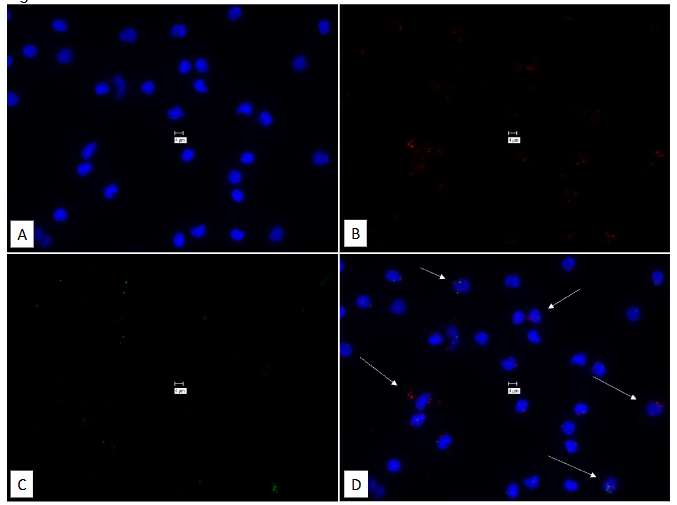 This image has an empty alt attribute; its file name is image-116.png