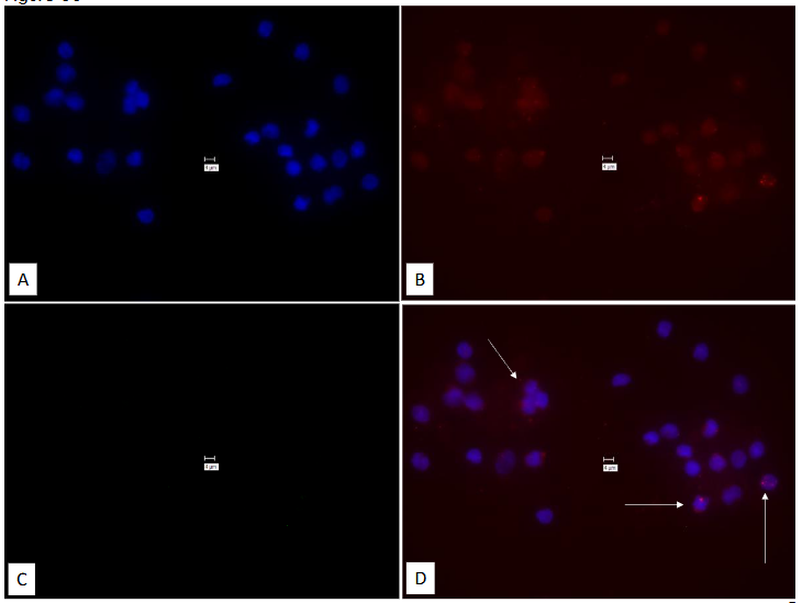 This image has an empty alt attribute; its file name is image-119.png