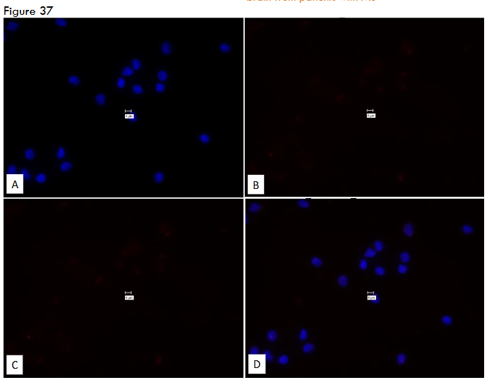 This image has an empty alt attribute; its file name is image-120.png