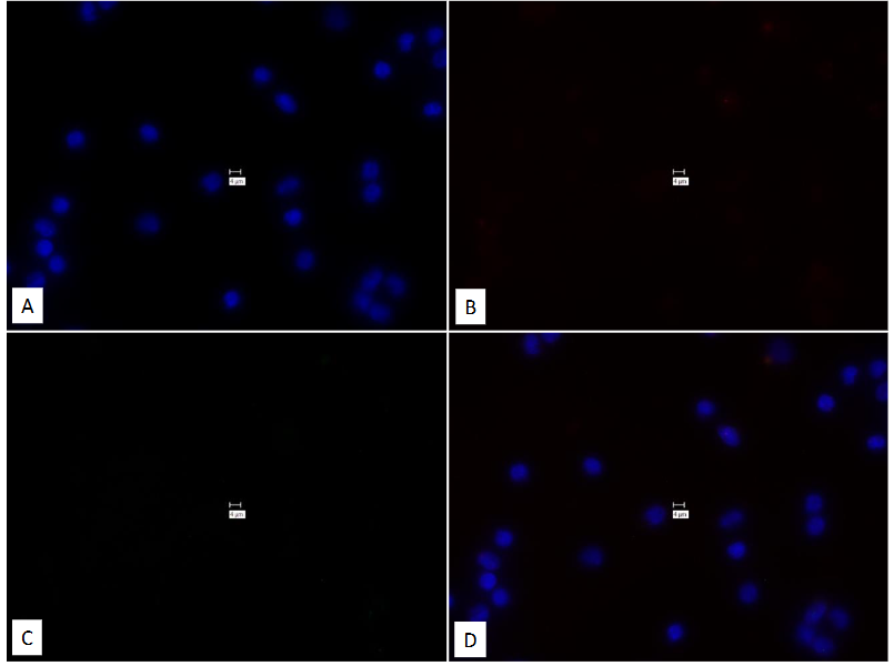 This image has an empty alt attribute; its file name is image-122.png