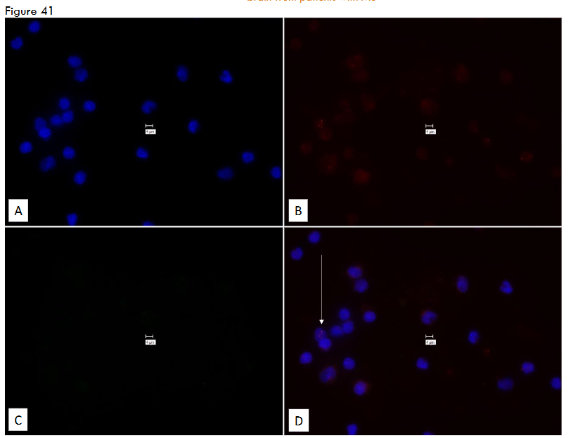 This image has an empty alt attribute; its file name is image-125.png