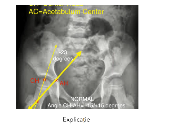 This image has an empty alt attribute; its file name is image-155.png