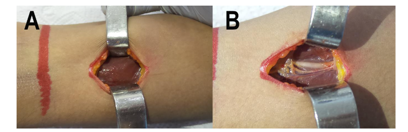 This image has an empty alt attribute; its file name is image-180.png