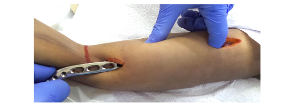 This image has an empty alt attribute; its file name is image-182.png