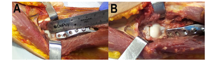 This image has an empty alt attribute; its file name is image-183.png