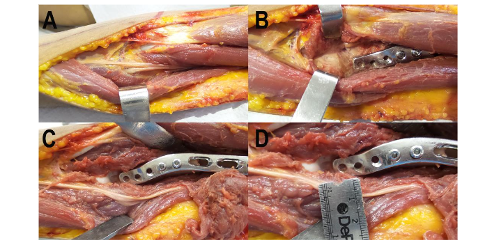 This image has an empty alt attribute; its file name is image-185.png