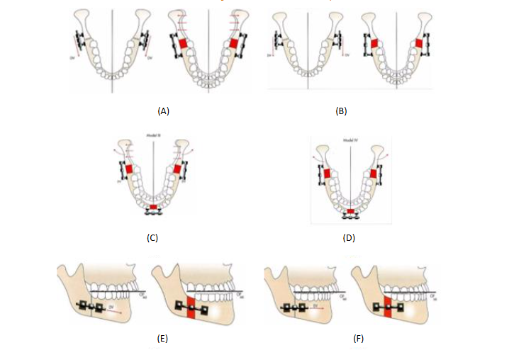 This image has an empty alt attribute; its file name is image-207.png