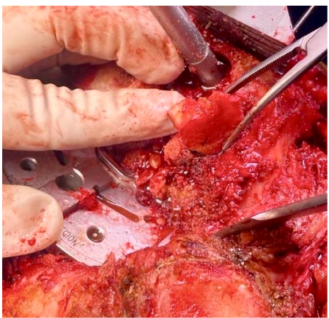 This image has an empty alt attribute; its file name is image-54.png